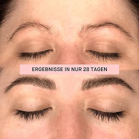 ROSEGOLD - Rosebrow Advance Serum for Eyebrows - 🥇 Achieve Long, Thick & Natural Growth! 🌟✨