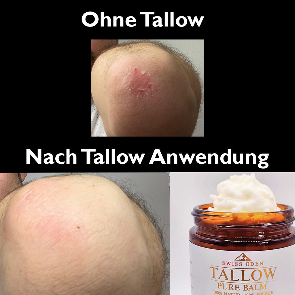 Schweizer Tallow Balm Pure – 100% Demeter Bio-Rindertalg ohne Zusätze von Swiss Eden